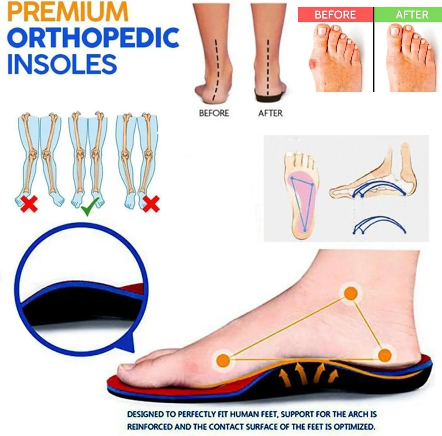 Clogs for Women Wide Width Wedge Sandals Arch Support Hollow Out Closed Toe Slip On Mules Shoes Breathable Cute Platform Beach Slippers