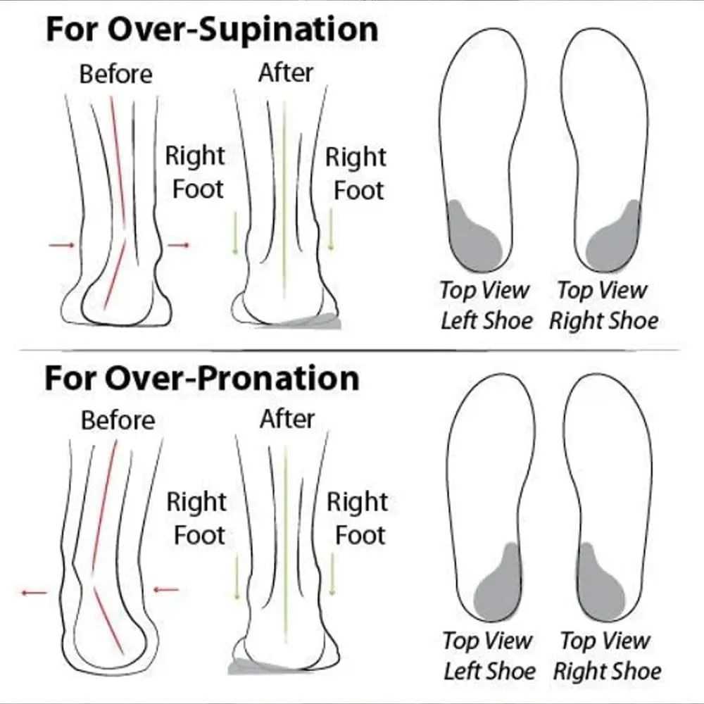 Women's Soft Sole Mesh Comfort Orthopedic Shoes - 2024 New Slip-on Walking Shoes with Arch Support